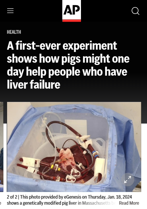 重大里程碑！科学家首次将猪肝移植到人体，成功过滤血液 72 小时